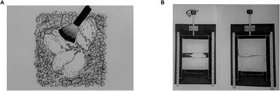 Neonatal Tactile Stimulations Affect Genetic Generalized Epilepsy and Comorbid Depression-Like Behaviors